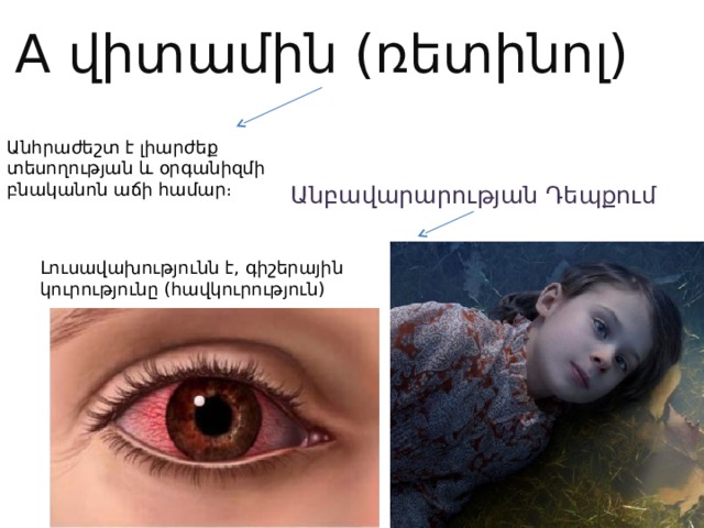 A վիտամին (ռետինոլ) Անհրաժեշտ է լիարժեք տեսողության և օրգանիզմի բնականոն աճի համար։ Անբավարարության Դեպքում Լուսավախությունն է, գիշերային կուրությունը (հավկուրություն) 