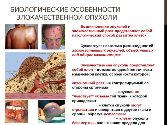 Биологические особенности злокачественной опухоли  Возникновение опухолей и злокачественный рост представляет собой патологический способ развития клеток   Существует несколько разновидностей злокачественных опухолей, объединенных под общим названием рак   Злокачественная опухоль представляет собой клон – потомство одной генетически измененной клетки, особенности которой: – автономный рост , не контролируемый со стороны организма – опухоль не “чувствует” объема той ткани, к которой принадлежит – клетки опухоли могут отрываться и внедряться в другие ткани и органы, образуя метастазы – клетки опухоли бессмертны , они не знают предела для размножения. 