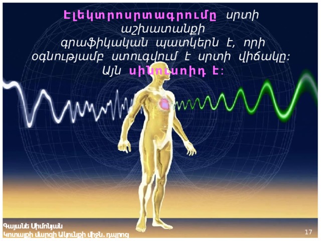Էլեկտրոսրտագրումը   սրտի աշխատանքի  գրաֆիկական պատկերն է, որի օգնությամբ ստուգվում է սրտի վիճակը: Այն սինուսոիդ է : Գայանե Սիմոնյան Կոտայքի մարզի Ակունքի միջն. դպրոց  