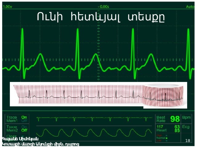 Ունի հետևյալ տեսքը Ունի հետևյալ տեսքը Գայանե Սիմոնյան Կոտայքի մարզի Ակունքի միջն. դպրոց  