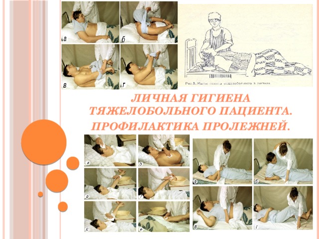  Личная гигиена тяжелобольного пациента. Профилактика пролежней. 