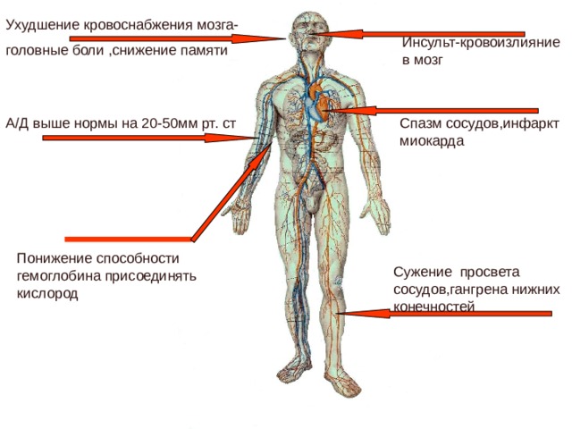 Ухудшение кровоснабжения мозга- головные боли ,снижение памяти Инсульт-кровоизлияние в мозг А/Д выше нормы на 20-50мм рт. ст Спазм сосудов,инфаркт миокарда Понижение способности гемоглобина присоединять кислород Сужение просвета сосудов,гангрена нижних конечностей 