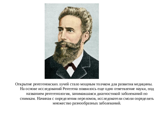 Открытие рентгеновских лучей стало мощным толчком для развития медицины. На основе исследований Рентгена появилось еще одно ответвление науки, под названием рентгенология, занимавшаяся диагностикой заболеваний по снимкам. Начиная с определения переломов, исследователи смоли определять множество разнообразных заболеваний. 