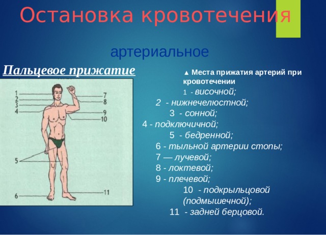 Остановка кровотечения артериальное Пальцевое прижатие ▲ Места прижатия артерий при кровотечении 1  - височной; ▲ Места прижатия артерий при кровотечении 1  - височной; ▲ Места прижатия артерий при кровотечении 1  - височной; ▲ Места прижатия артерий при кровотечении 1  - височной; 2  - нижнечелюстной; 2  - нижнечелюстной; 3  - сонной; 3  - сонной; 3  - сонной; 4 - подключичной; 5  - бедренной; 5  - бедренной; 5  - бедренной; 6 - тыльной артерии стопы; 7 — лучевой; 8 - локтевой; 9 - плечевой; 6 - тыльной артерии стопы; 7 — лучевой; 8 - локтевой; 9 - плечевой; 10  - подкрыльцовой (подмышечной); 10  - подкрыльцовой (подмышечной); 10  - подкрыльцовой (подмышечной); 10  - подкрыльцовой (подмышечной); 11  - задней берцовой. 11  - задней берцовой. 11  - задней берцовой. 