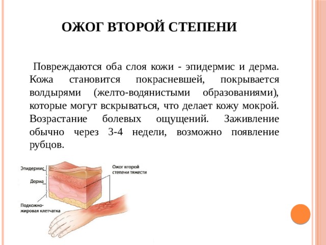 Ожог второй степени  Повреждаются оба слоя кожи - эпидермис и дерма. Кожа становится покрасневшей, покрывается волдырями (желто-водянистыми образованиями), которые могут вскрываться, что делает кожу мокрой. Возрастание болевых ощущений. Заживление обычно через 3-4 недели, возможно появление рубцов. 