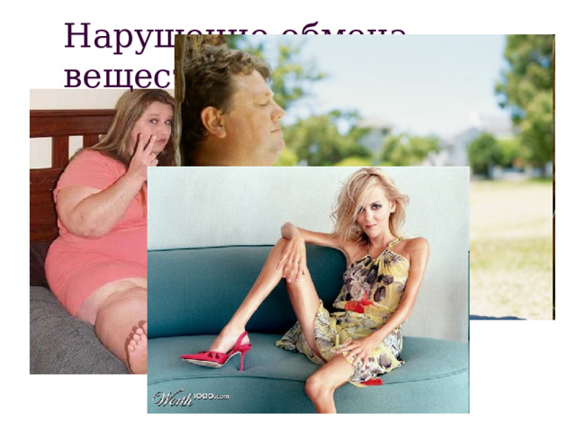 Нарушение обмена веществ 