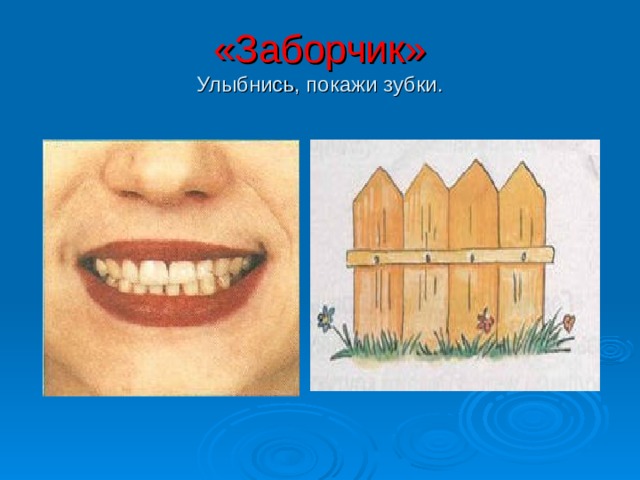 «Заборчик»  Улыбнись, покажи зубки. 