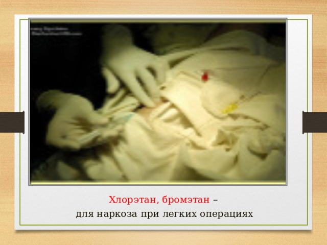 Хлорэтан, бромэтан – для наркоза при легких операциях 