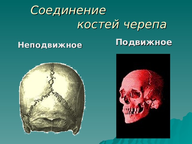 Соединение  костей черепа Подвижное   Неподвижное  
