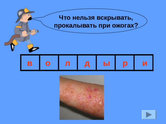 Что нельзя вскрывать,  прокалывать при ожогах? в о л д ы р и 