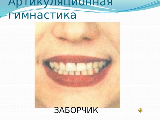 Артикуляционная гимнастика ЗАБОРЧИК 