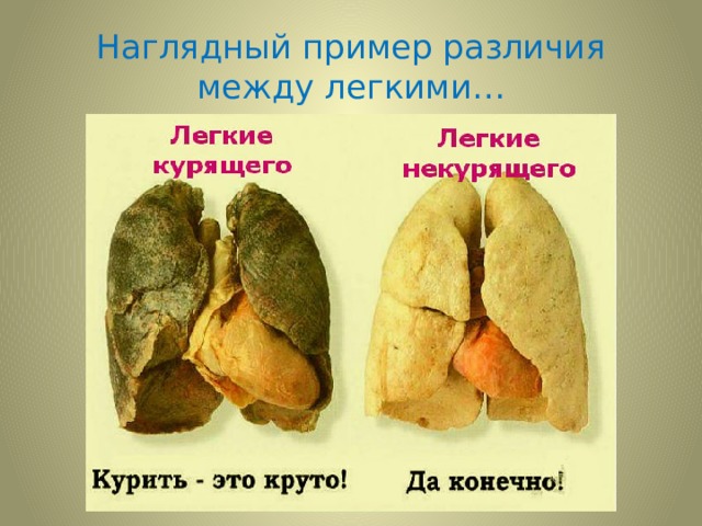 Наглядный пример различия между легкими… 