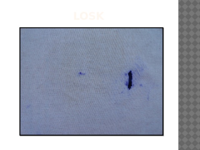 Losk 