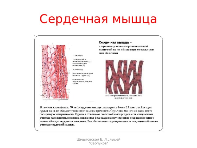 Сердечная мышца Шишловская Е. Л., лицей 