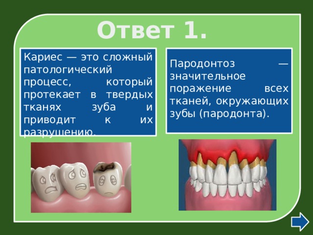 Ответ 1. Кариес — это сложный патологический процесс, который протекает в твердых тканях зуба и приводит к их разрушению.  Пародонтоз — значительное поражение всех тканей, окружающих зубы (пародонта). 