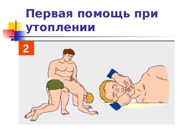 Первая помощь при утоплении 