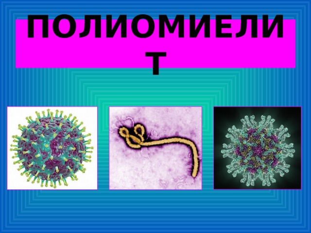 ПОЛИОМИЕЛИТ 