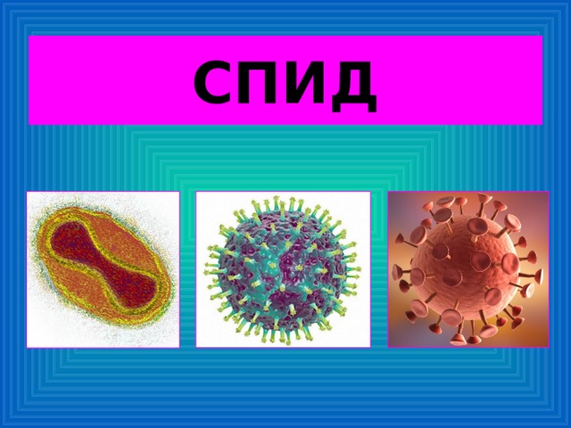 СПИД 
