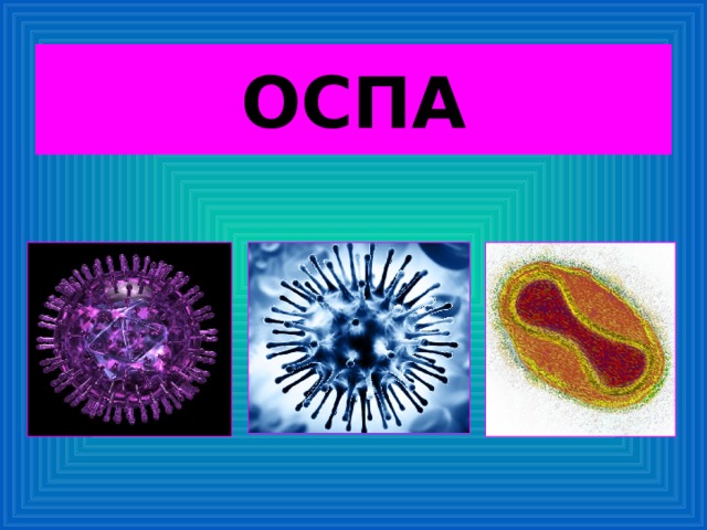 ОСПА 