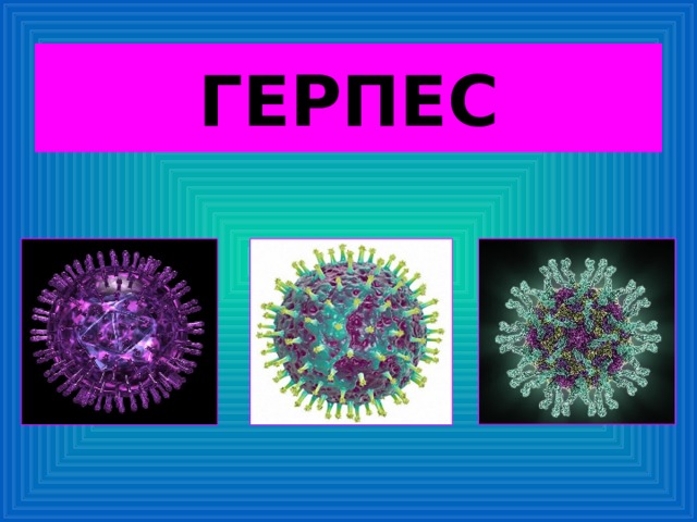 ГЕРПЕС 