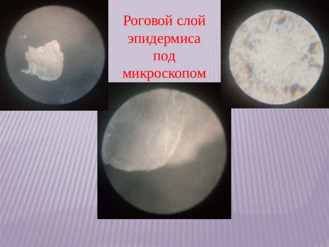 Роговой слой эпидермиса под микроскопом 