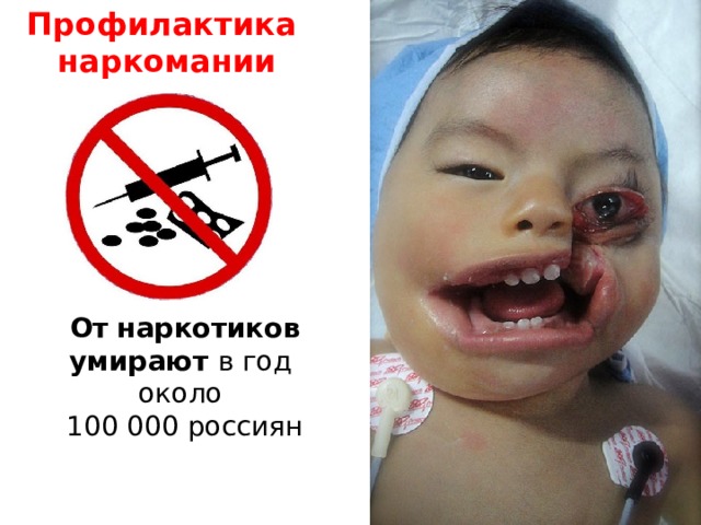 Профилактика наркомании От   наркотиков умирают в год  около 100 000 россиян 