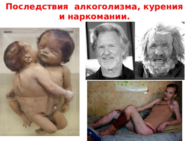 Последствия алкоголизма, курения и наркомании. 