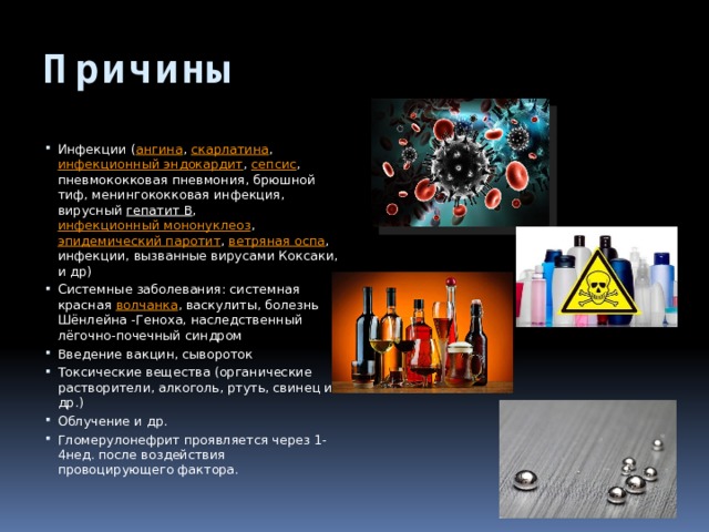 Причины Инфекции ( ангина ,  скарлатина ,  инфекционный эндокардит ,  сепсис , пневмококковая пневмония, брюшной тиф, менингококковая инфекция, вирусный  гепатит В ,  инфекционный мононуклеоз ,  эпидемический паротит ,  ветряная оспа , инфекции, вызванные вирусами Коксаки, и др) Системные заболевания: системная красная  волчанка , васкулиты, болезнь Шёнлейна -Геноха, наследственный лёгочно-почечный синдром Введение вакцин, сывороток Токсические вещества (органические растворители, алкоголь, ртуть, свинец и др.) Облучение и др. Гломерулонефрит проявляется через 1-4нед. после воздействия провоцирующего фактора. 