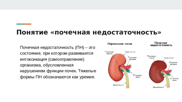 Понятие «почечная недостаточность» Почечная недостаточность (ПН) – это состояние, при котором развивается интоксикация (самоотравление) организма, обусловленная нарушением функции почек. Тяжелые формы ПН обозначаются как уремия. 