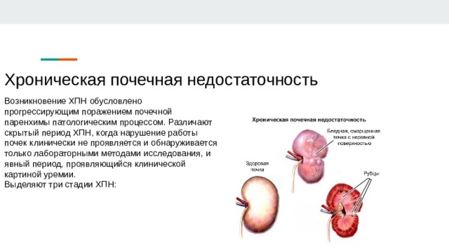 Хроническая почечная недостаточность  Возникновение ХПН обусловлено прогрессирующим поражением почечной паренхимы патологическим процессом. Различают скрытый период ХПН, когда нарушение работы почек клинически не проявляется и обнаруживается только лабораторными методами исследования, и явный период, проявляющийся клинической картиной уремии. Выделяют три стадии ХПН: 
