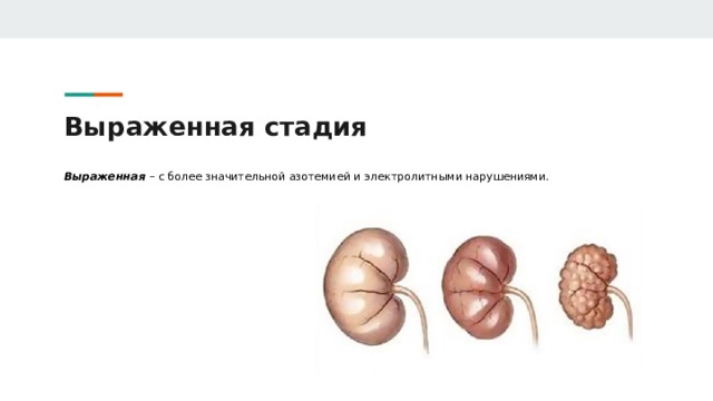Выраженная стадия Выраженная – с более значительной азотемией и электролитными нарушениями. 