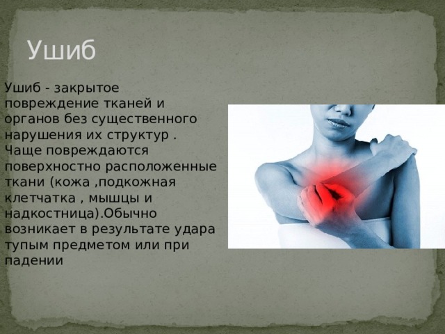 Ушиб Ушиб - закрытое повреждение тканей и органов без существенного нарушения их структур . Чаще повреждаются поверхностно расположенные ткани (кожа ,подкожная клетчатка , мышцы и надкостница).Обычно возникает в результате удара тупым предметом или при падении   