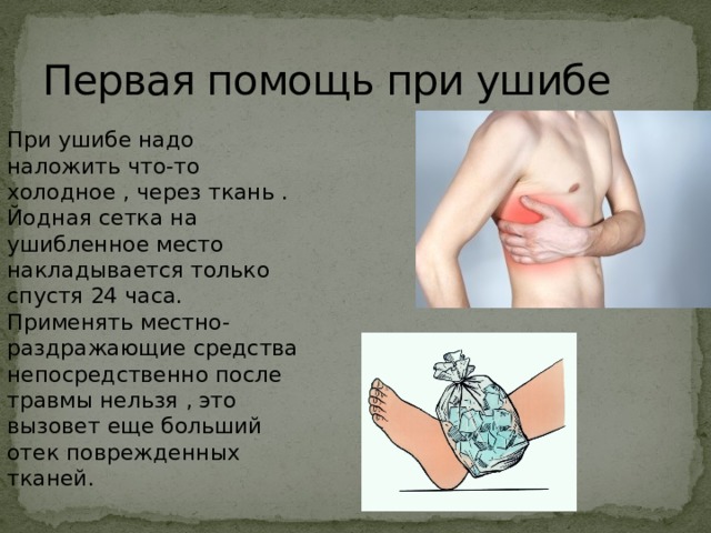 Первая помощь при ушибе При ушибе надо наложить что-то холодное , через ткань . Йодная сетка на ушибленное место накладывается только спустя 24 часа. Применять местно-раздражающие средства непосредственно после травмы нельзя , это вызовет еще больший отек поврежденных тканей. 