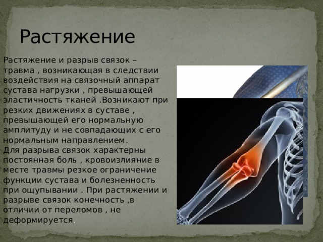 Растяжение Растяжение и разрыв связок – травма , возникающая в следствии воздействия на связочный аппарат сустава нагрузки , превышающей эластичность тканей .Возникают при резких движениях в суставе , превышающей его нормальную амплитуду и не совпадающих с его нормальным направлением.  Для разрыва связок характерны постоянная боль , кровоизлияние в месте травмы резкое ограничение функции сустава и болезненность при ощупывании . При растяжении и разрыве связок конечность ,в отличии от переломов , не деформируется . 