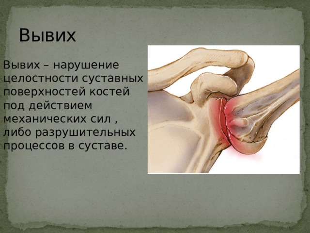 Вывих Вывих – нарушение целостности суставных поверхностей костей под действием механических сил , либо разрушительных процессов в суставе. 