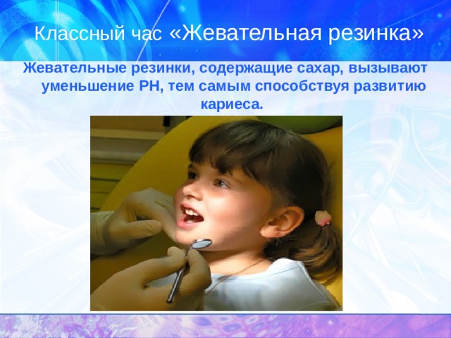 Классный час «Жевательная резинка» Жевательные резинки, содержащие сахар, вызывают  уменьшение P Н, тем самым способствуя развитию кариеса. 