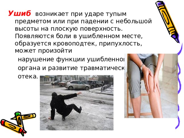 Ушиб  возникает при ударе тупым предметом или при падении с небольшой высоты на плоскую поверхность. Появляются боли в ушибленном месте, образуется кровоподтек, припухлость, может произойти  нарушение функции ушибленного  органа и развитие травматического  отека. 