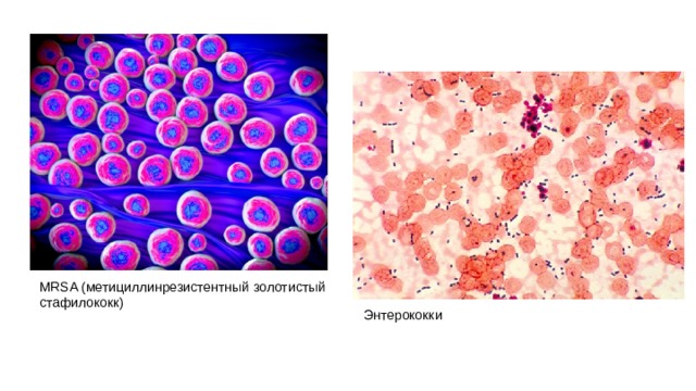 MRSA (метициллинрезистентный золотистый стафилококк) Энтерококки 