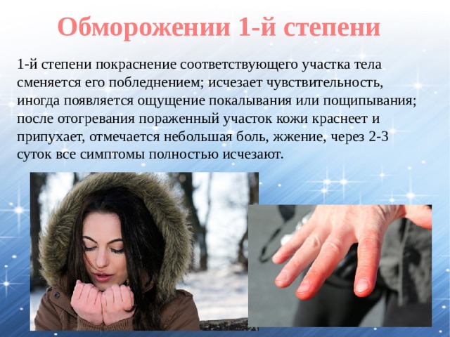 Обморожении 1-й степени 1-й степени покраснение соответствующего участка тела сменяется его побледнением; исчезает чувствительность, иногда появляется ощущение покалывания или пощипывания; после отогревания пораженный участок кожи краснеет и припухает, отмечается небольшая боль, жжение, через 2-3 суток все симптомы полностью исчезают. 