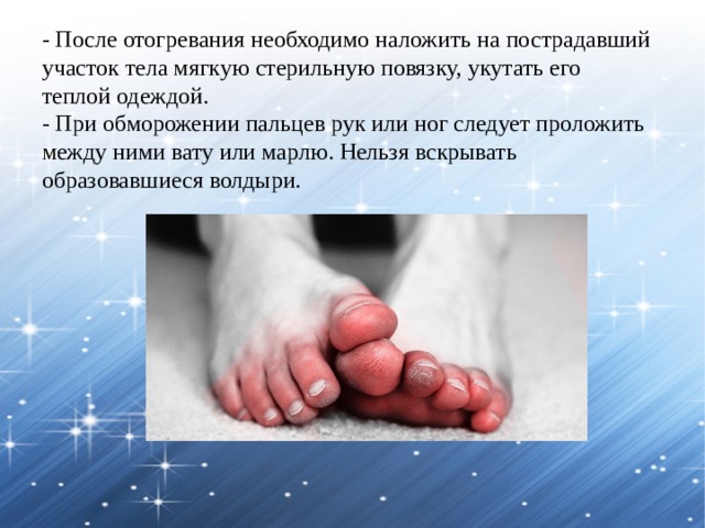 - После отогревания необходимо наложить на пострадавший участок тела мягкую стерильную повязку, укутать его теплой одеждой. - При обморожении пальцев рук или ног следует проложить между ними вату или марлю. Нельзя вскрывать образовавшиеся волдыри. 