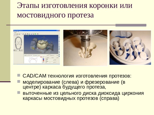 Этапы изготовления коронки или мостовидного протеза   CAD/CAM технология изготовления протезов: моделирование (слева) и фрезерование (в центре) каркаса будущего протеза, выточенные из цельного диска диоксида циркония каркасы мостовидных протезов (справа) 