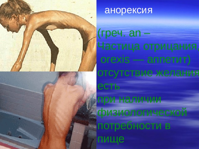 анорексия (греч. an – Частица отрицания,  orexis — аппетит) отсутствие желания есть при наличии физиологической потребности в пище  