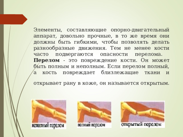 Элементы, составляющие опорно-двигательный аппарат, довольно прочные, в то же время они должны быть гибкими, чтобы позволять делать разнообразные движения. Тем не менее кости часто подвергаются опасности перелома.  Перелом - это повреждение кости. Он может быть полным и неполным. Если перелом полный, а кость повреждает близлежащие ткани и открывает рану в коже, он называется открытым.  