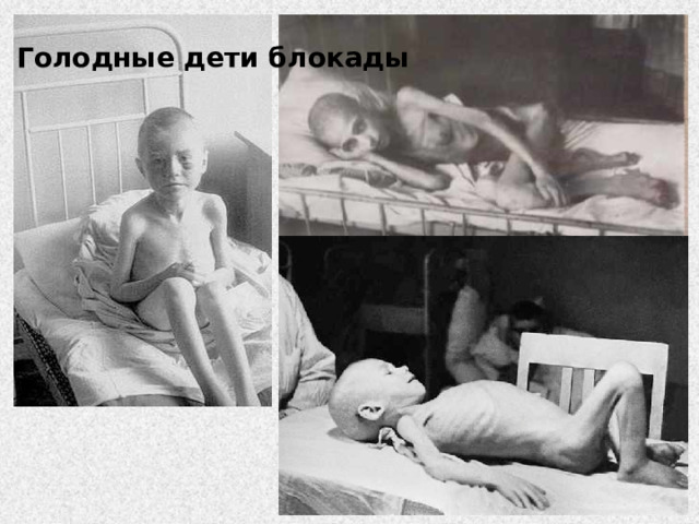 Голодные дети блокады 