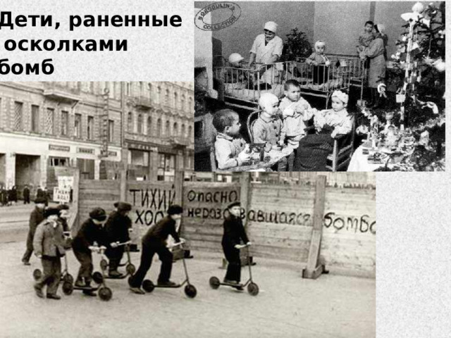 Дети, раненные  осколками бомб 