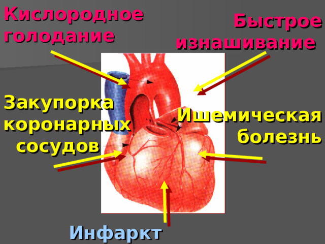 Кислородное голодание Быстрое изнашивание  Закупорка коронарных сосудов  Ишемическая болезнь Инфаркт миокарда  