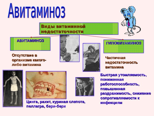 Виды витаминной недостаточности АВИТАМИНОЗ  ГИПОВИТАМИНОЗ  Отсутствие в организме какого-либо витамина Частичная недостаточность витамина Быстрая утомляемость, пониженная работоспособность, повышенная раздражимость, снижение сопротивляемости к инфекциям Цинга, рахит, куриная слепота, пеллагра, бери-бери 