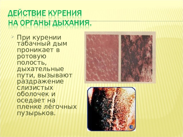 При курении табачный дым проникает в ротовую полость, дыхательные пути, вызывают раздражение слизистых оболочек и оседает на пленке лёгочных пузырьков. 