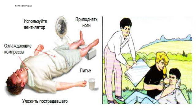 Тепловой удар 