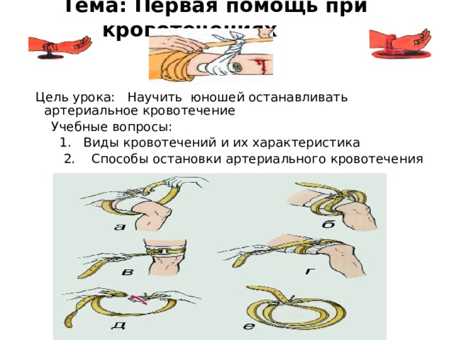 Тема: Первая помощь при кровотечениях       Цель урока: Научить юношей останавливать артериальное кровотечение  Учебные вопросы:  1. Виды кровотечений и их характеристика  2. Способы остановки артериального кровотечения 